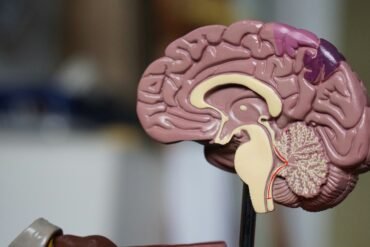 Neurologia em metáforas — Uma história clínica