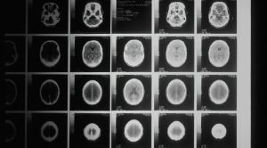 a black and white photo of various mri images