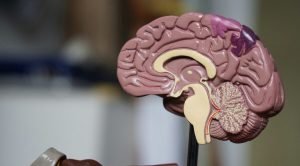 Neurologia em metáforas — Uma história clínica